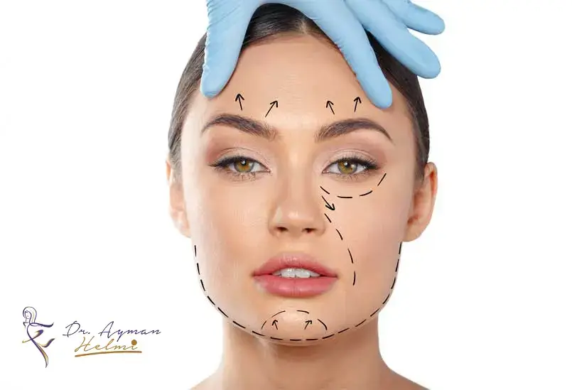 يعتبر المشد من الأدوات الطبية التي تستخدم لضم الجلد والنسيج الضام بعد إجراء عملية تجميلية، مثل عملية شد الوجه.