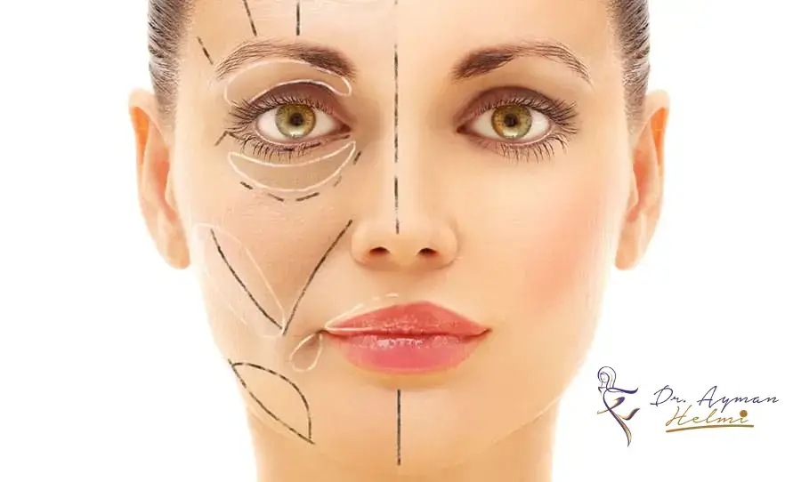 حقن الدهون الذاتية هي إجراء تجميلي يستخدم لتحسين مظهر الوجه والجسم بشكل عام.